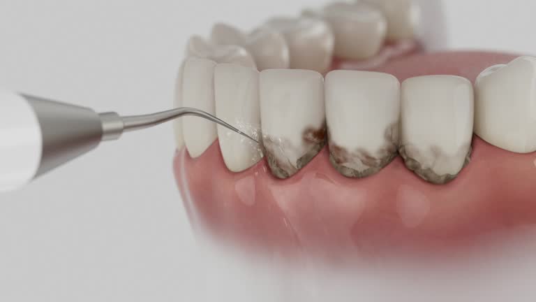 Reliable Dental Implants contractor in Antioch, CA by Smile Center Dentistry